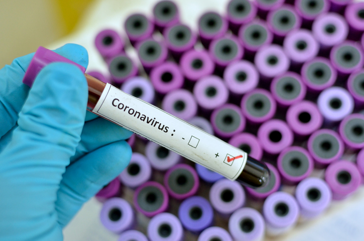 gobierno-de-cdmx-aplicara-test-de-coronavirus-con-sms-asi-es-como-funcionan