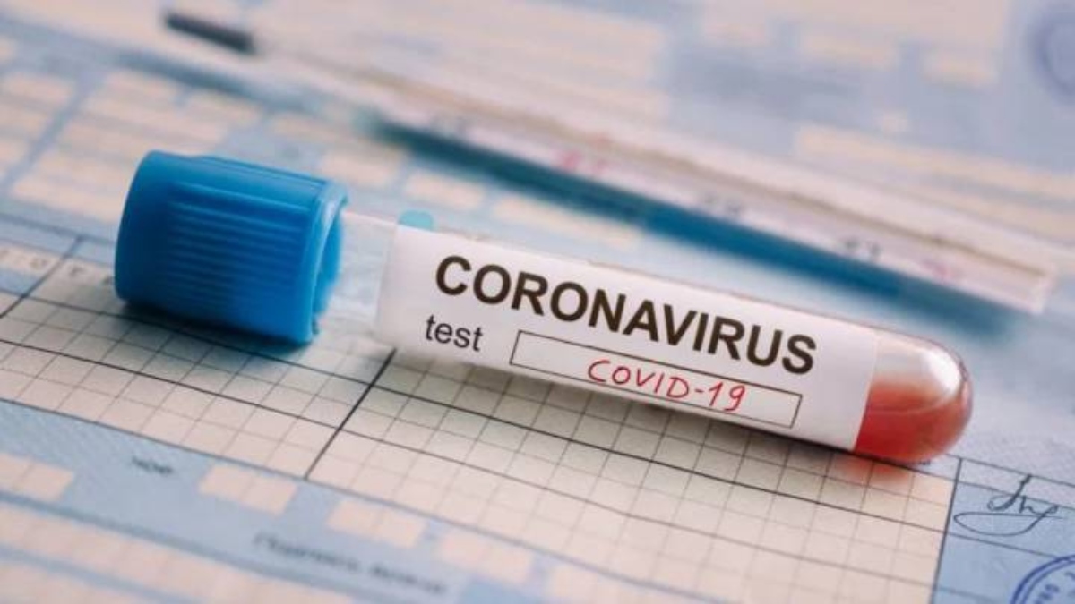 cientificos-del-ipn-trabajan-en-dispositivos-capaz-de-detectar-coronavirus-en-minutos