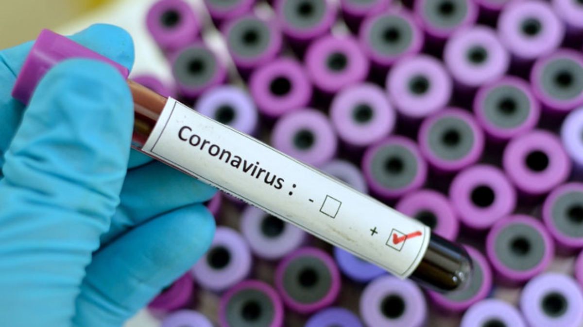 que-han-hecho-las-empresas-de-tecnologia-para-luchar-contra-la-pandemia-de-coronavirus